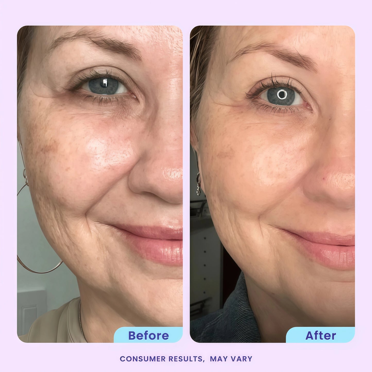 goPure Advanced Repair Eye Cream - Under Eye Cream for Puffiness, Bags, and Dark Circles, Visibly Improve the Look of Fine Lines, Wrinkles, and Crows Feet - 0.57 fl oz