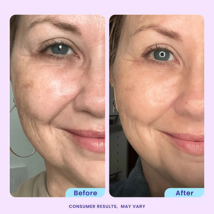 goPure Advanced Repair Eye Cream - Under Eye Cream for Puffiness, Bags, and Dark Circles, Visibly Improve the Look of Fine Lines, Wrinkles, and Crows Feet - 0.57 fl oz